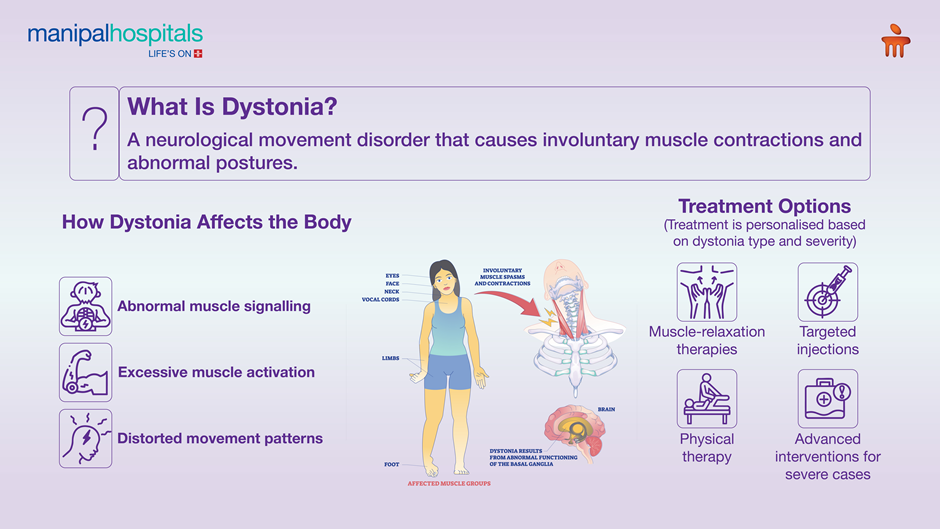 dystonia symptoms