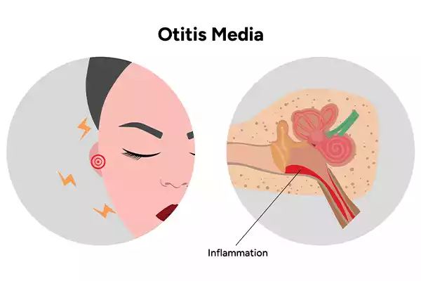 Ear Infection Symptoms