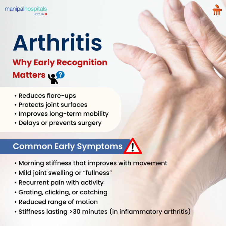 Early Signs of Arthritis and How to Act Before Joint Damage