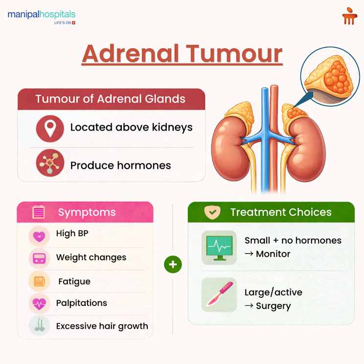 What is Adrenal Tumour: Symptoms, Causes & Treatment Explained