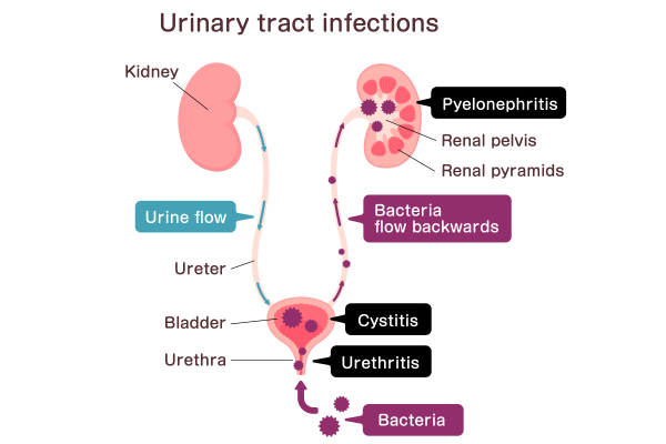 Foamy Urine: Causes, Symptoms & Treatment Explained