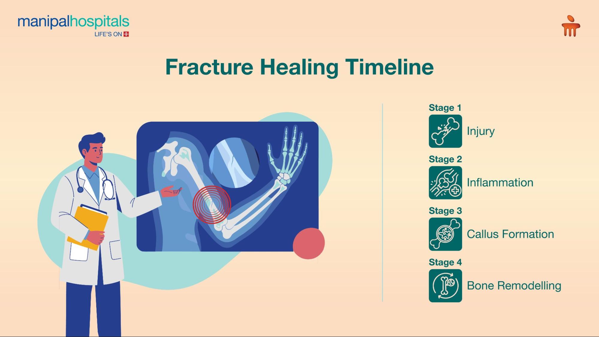 Fracture management