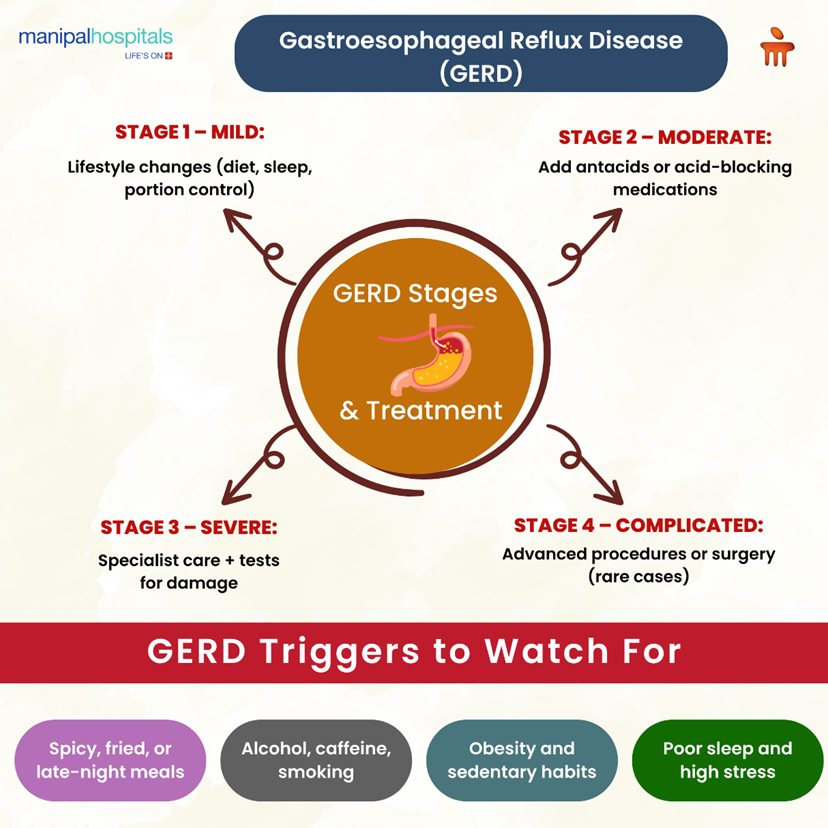 Understanding GERD Stages: Your Guide to Effective Treatment