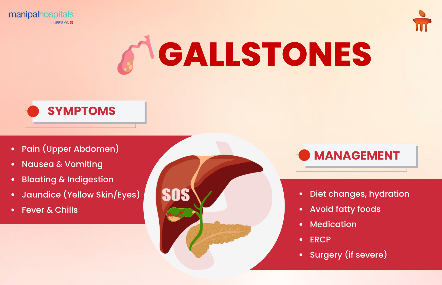 Gallstones Treatment-Symptoms, Causes, and Surgery Options