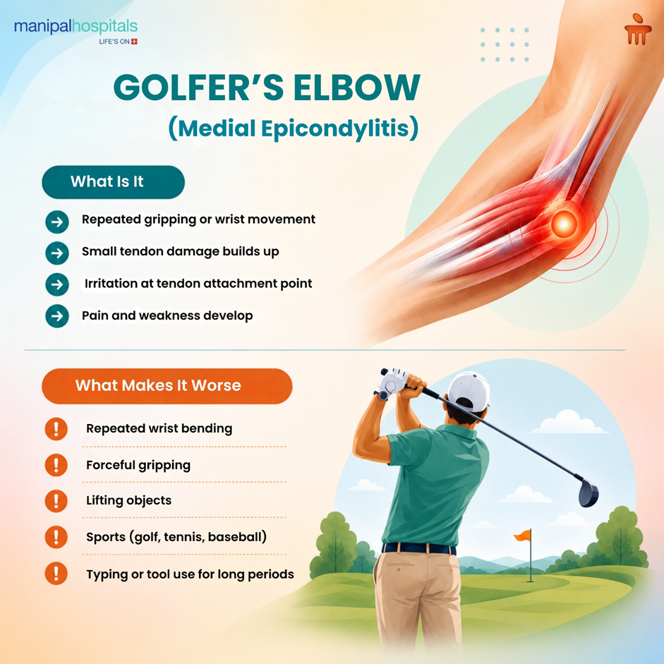 Understanding Golfer’s Elbow: Why Inner Elbow Pain Happens and How It Is Treated