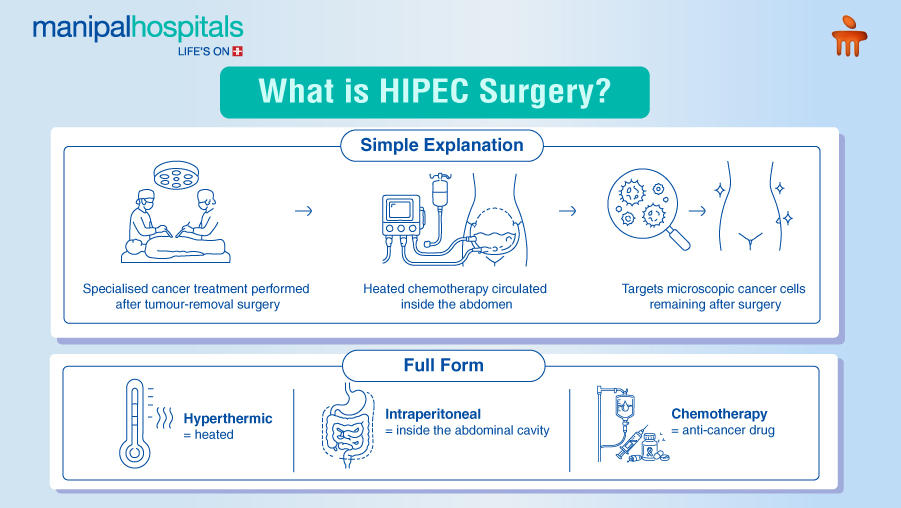 HIPEC surgery for colon cancer