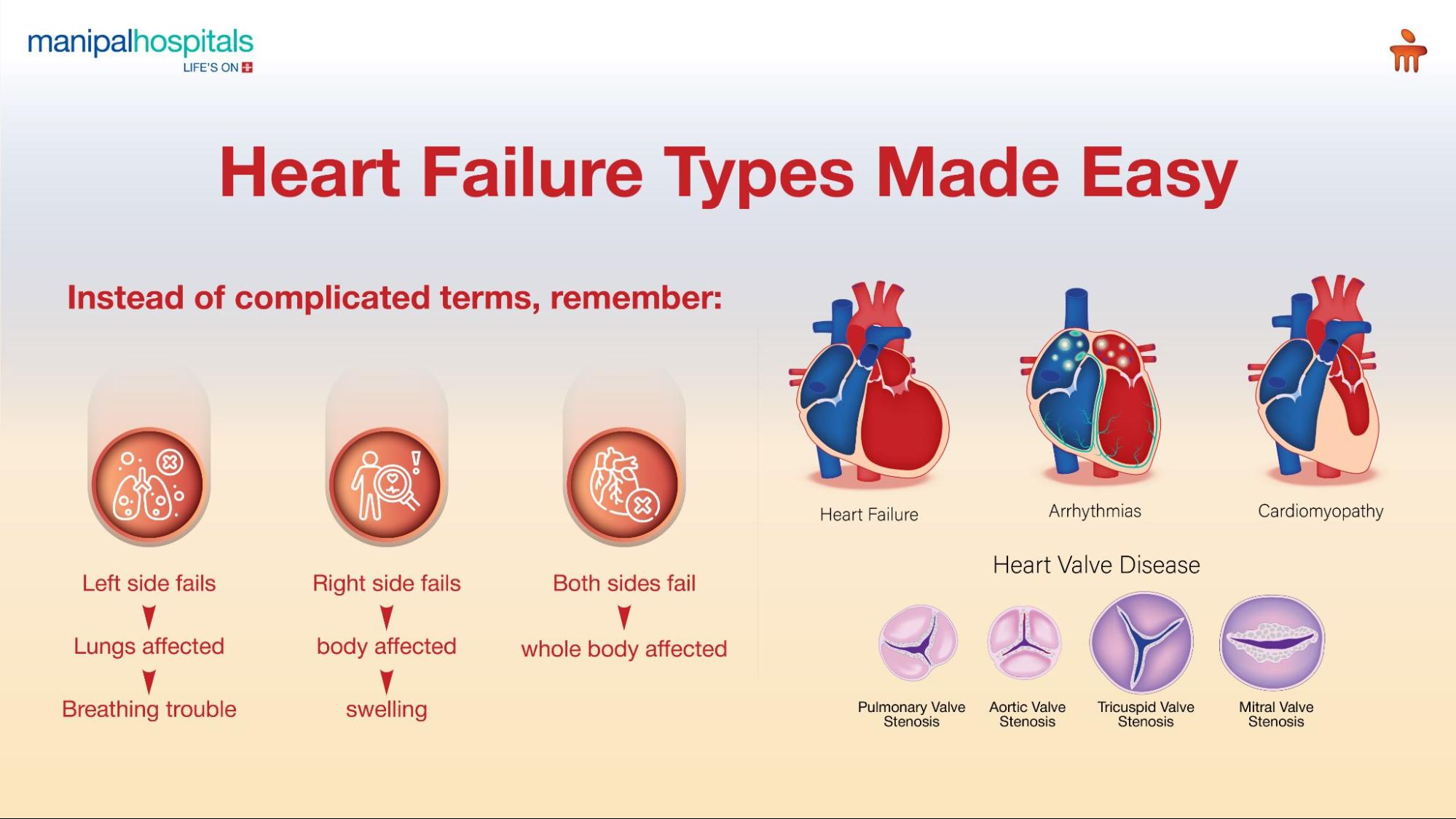 Heart failure symptoms causes and treatment explained