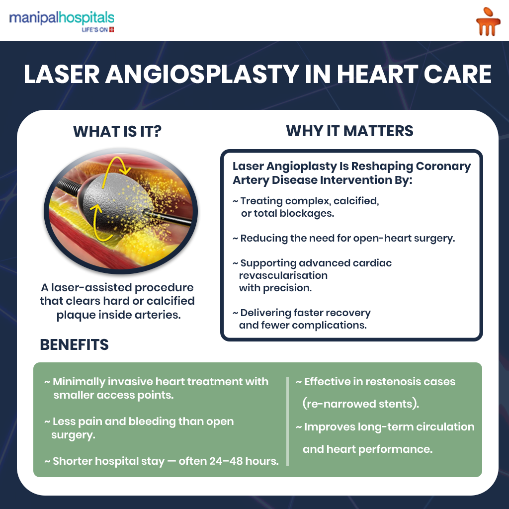 How Laser Angioplasty is Revolutionising Heart Care