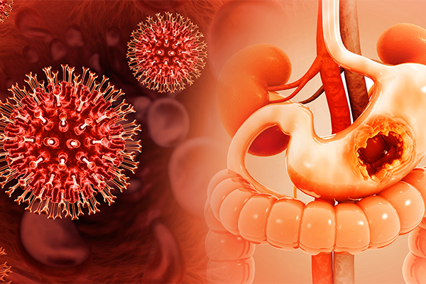 How to Get Rid of Gastritis Permanently