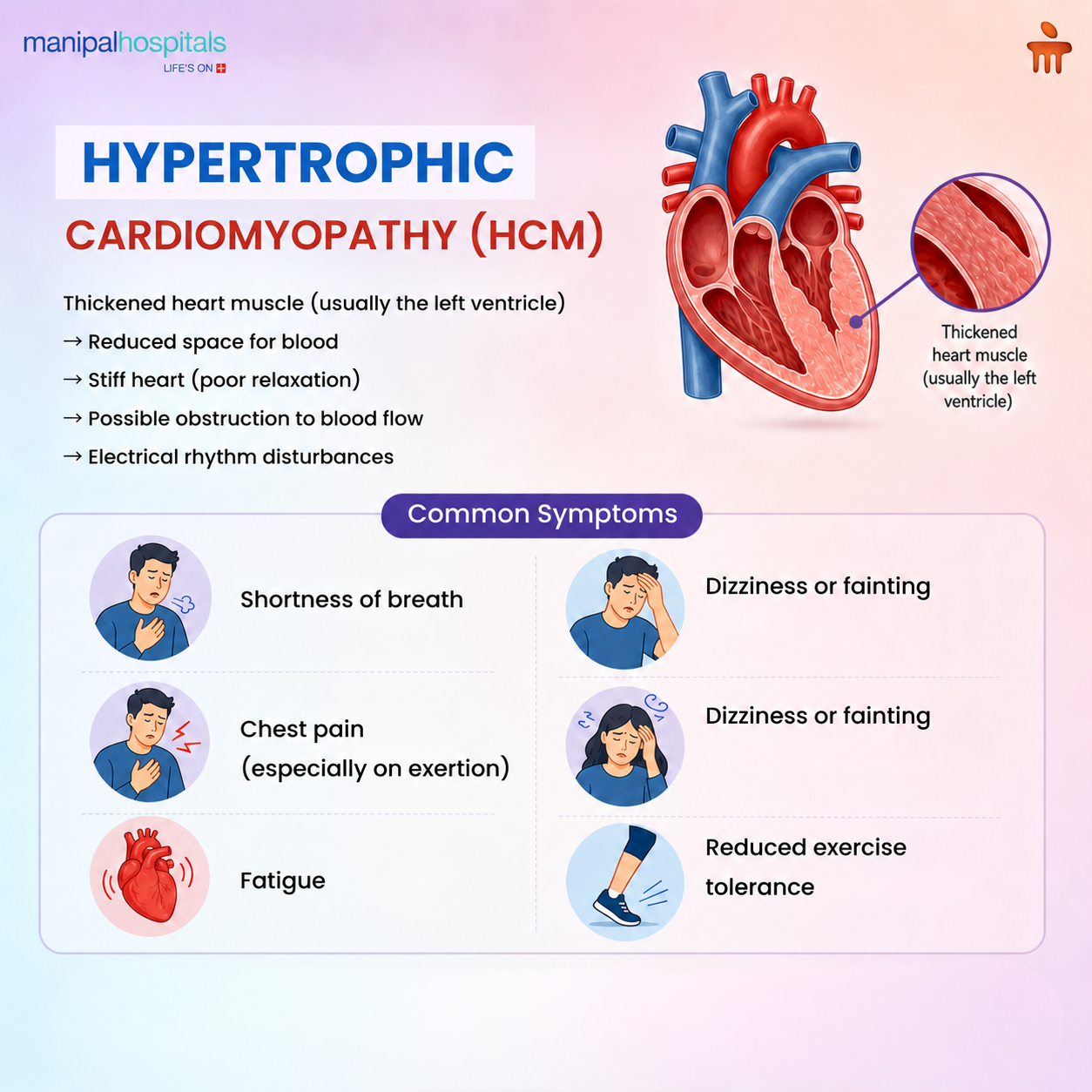 hypertrophic-cardiomyopathy-patient-guide