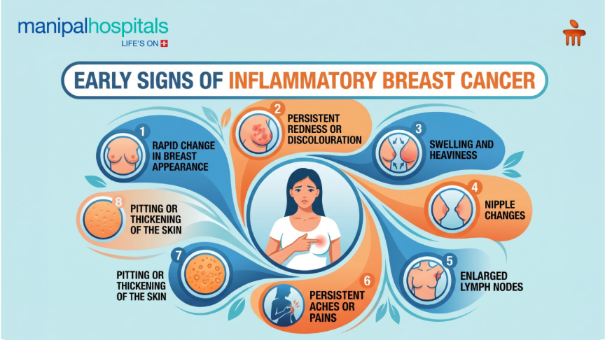 Inflammatory Breast Cancer: Early Signs You Shouldn’t Ignore