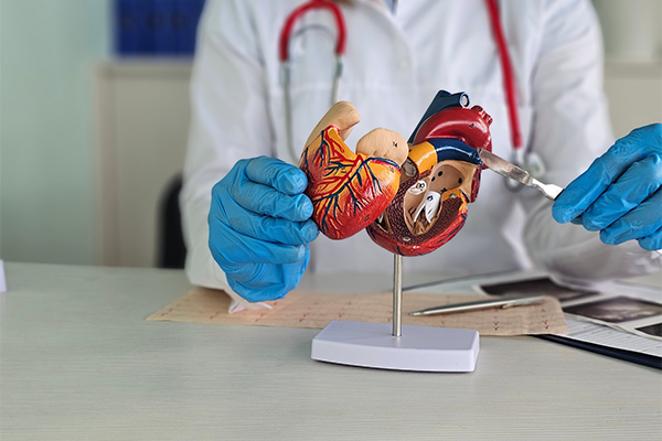 Is Heart Valve Replacement Right for You? Symptoms, Surgery, and Alternatives