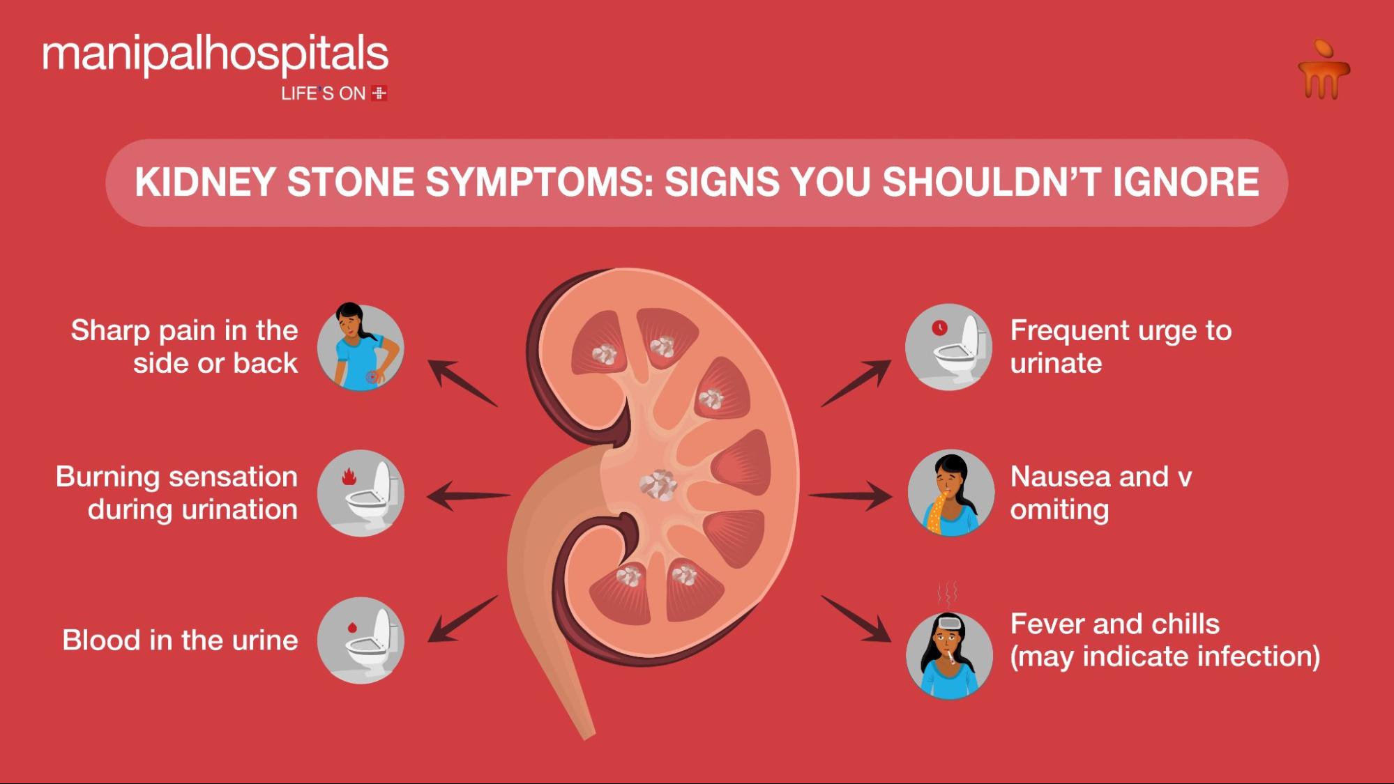 Kidney Stone Symptoms