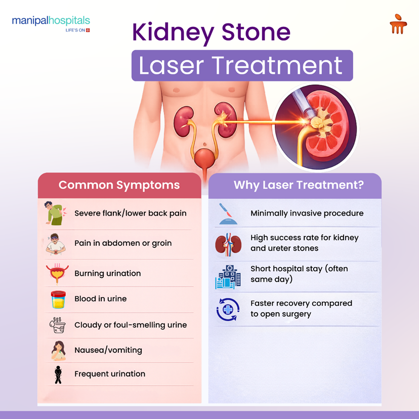 Kidney Stone Laser Treatment: Procedure, Recovery & Myths