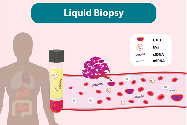 Liquid Biopsy Non Invasive Cancer Testing