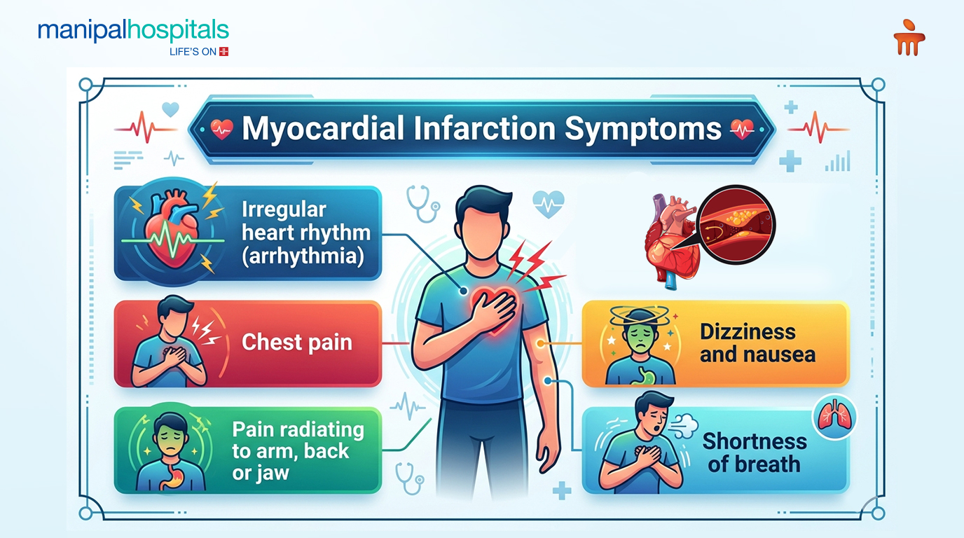 myocardial-infarction-treatment