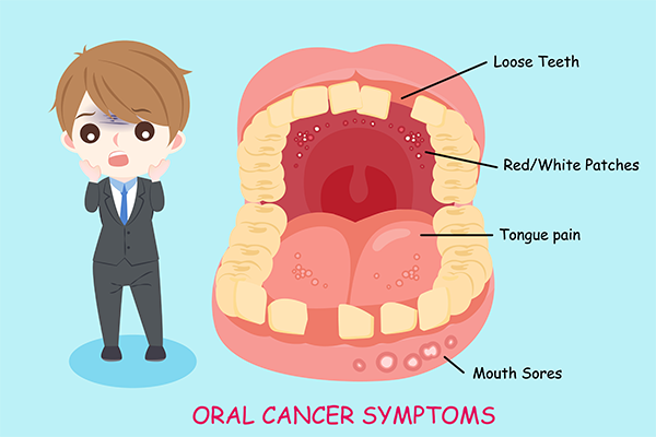 Oral Cancer: Early Signs, Causes & Effective Treatment Options