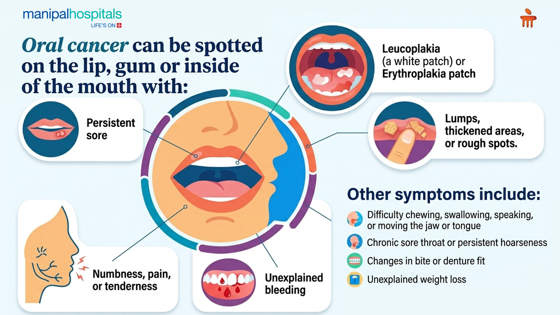 Mouth Cancer Symptoms