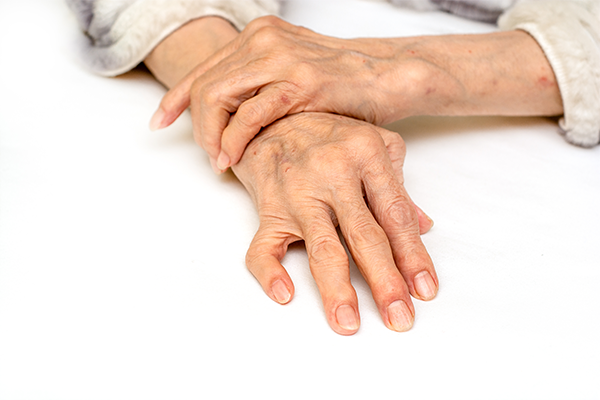 Osteoporosis: Gradually Weakening Bones – Symptoms and Prevention
