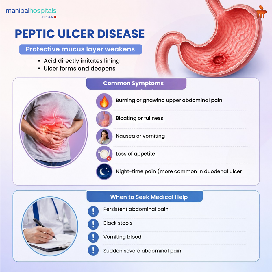 Peptic Ulcer Disease: Symptoms, Types, Causes & Treatment