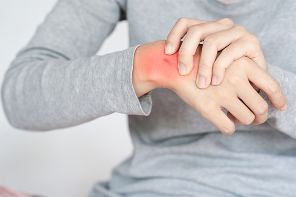 Red Rashes on Skin