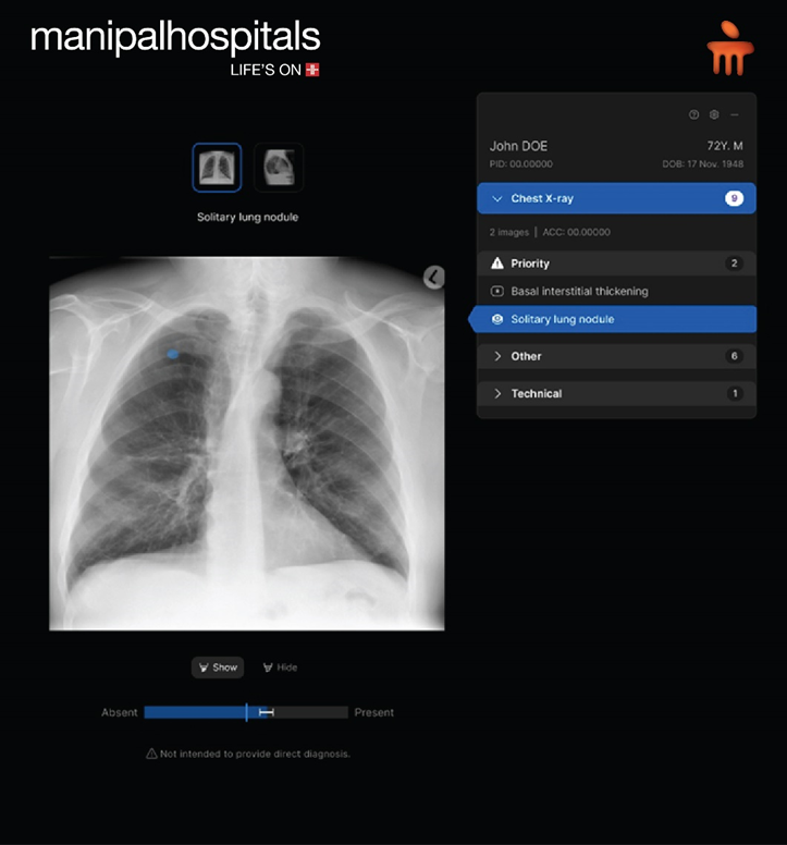 See More, Miss Less: How Comprehensive AI Is Advancing Patient Care at Manipal Hospitals