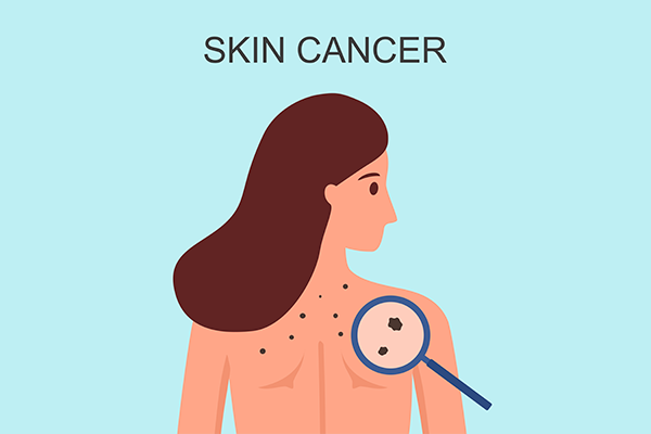 skin-cancer-symptoms-rashes-itching