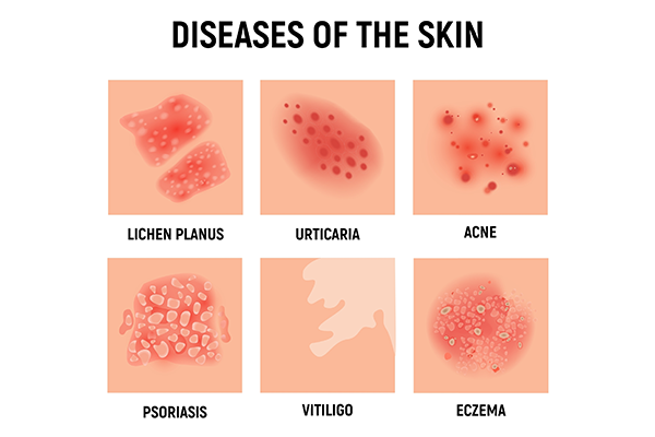 skin rashes