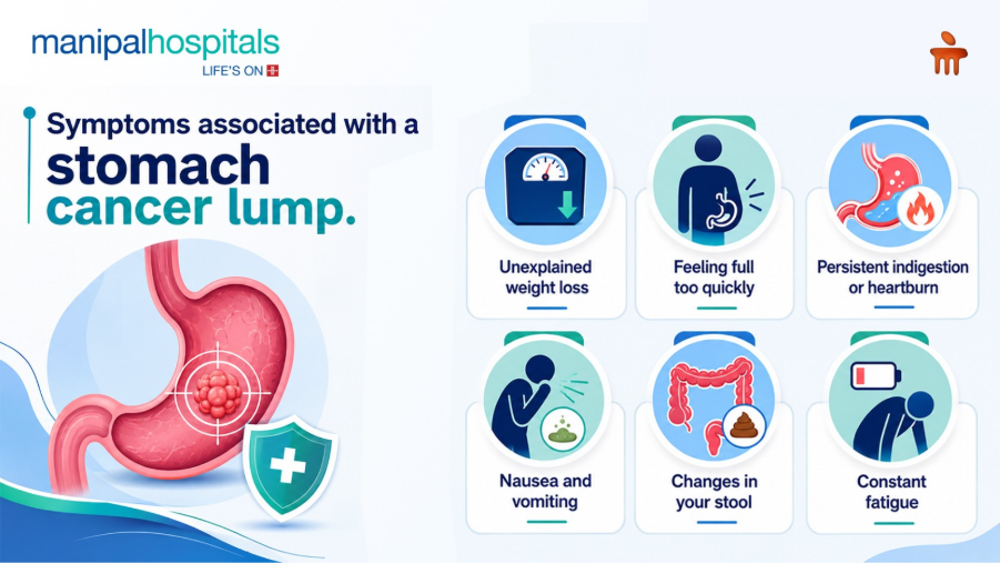 Stomach cancer lump
