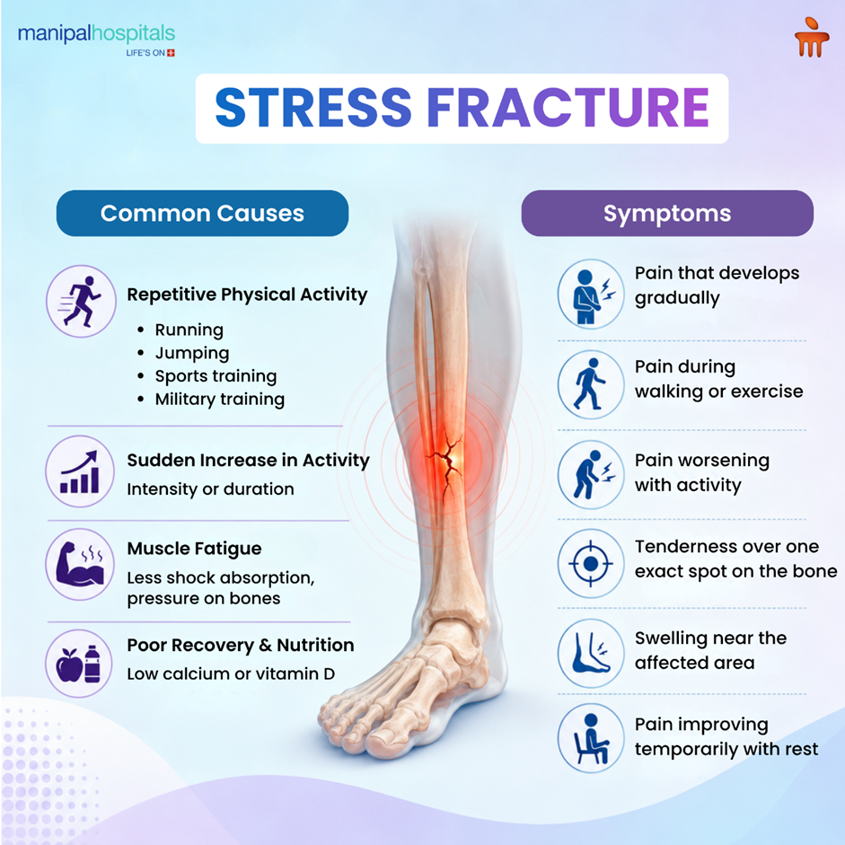 Stress Fracture Treatment Explained: When Rest Works and When Surgery Is Needed