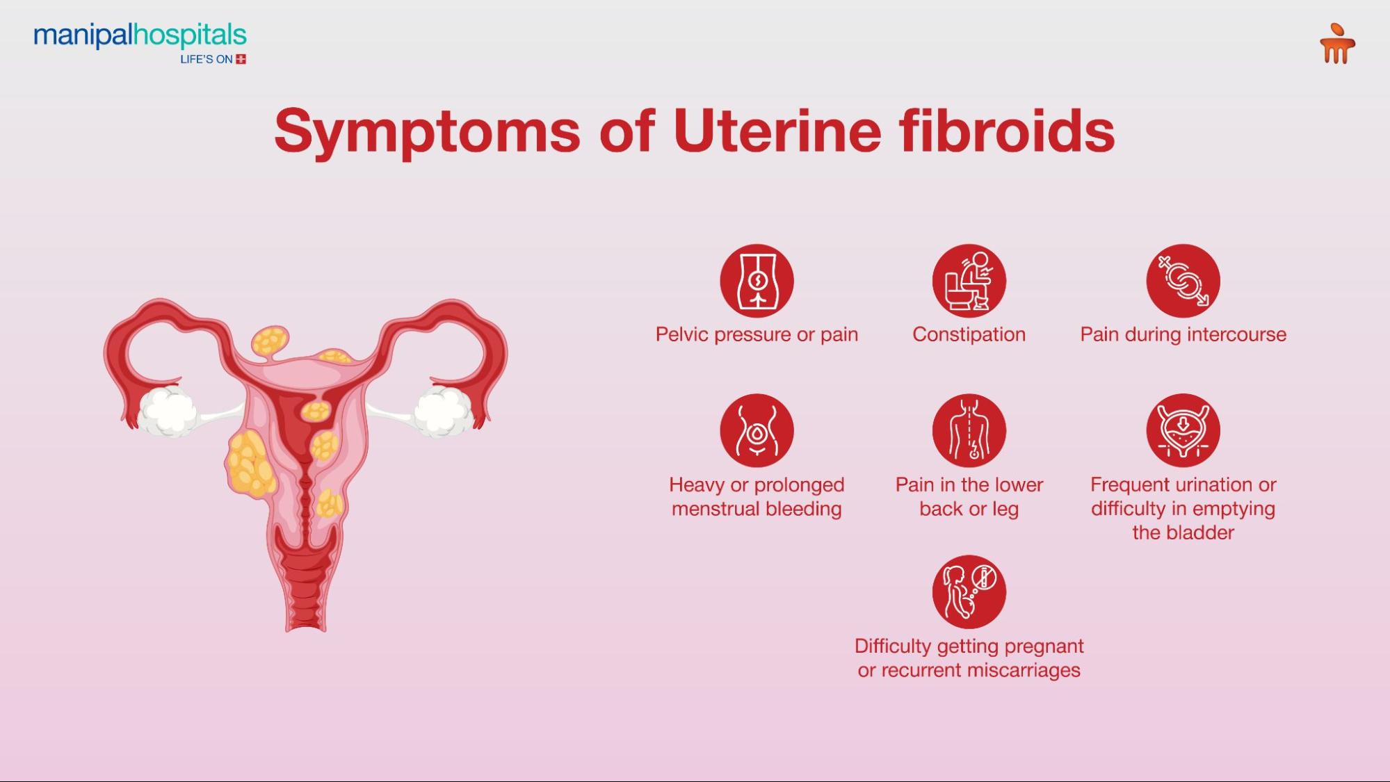  Symptoms of Uterine Fibroids