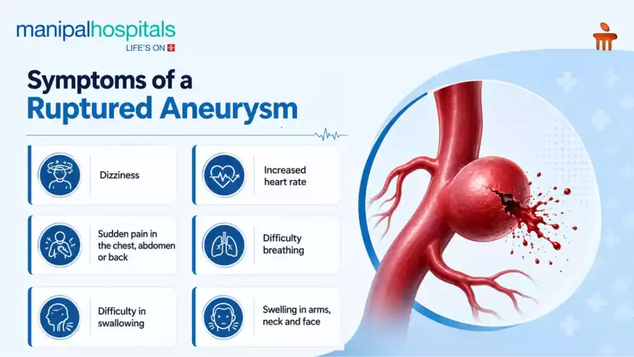 aorta enlargement medical scan