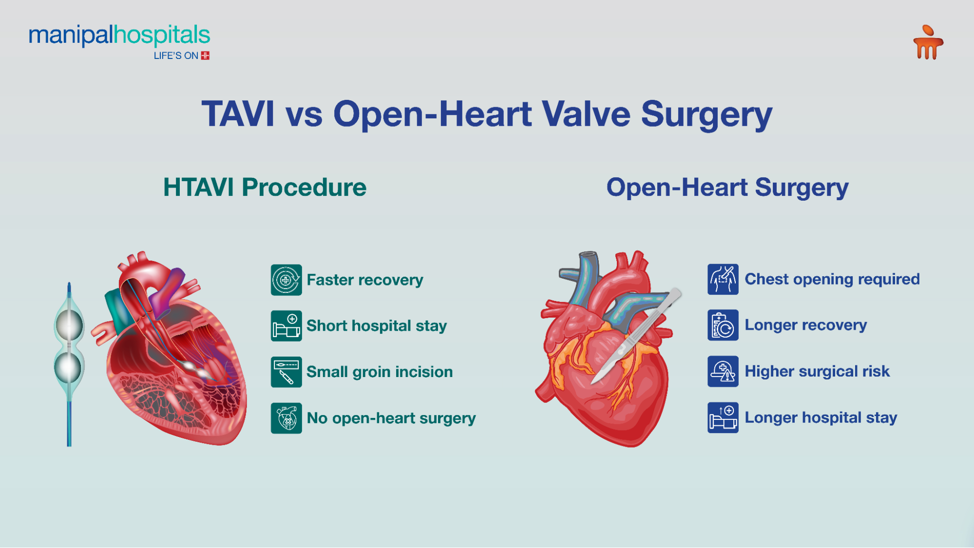 What Is TAVI? A Minimally Invasive Treatment for Aortic Stenosis