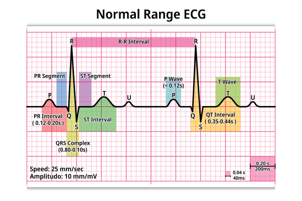 Heart block types and treatment