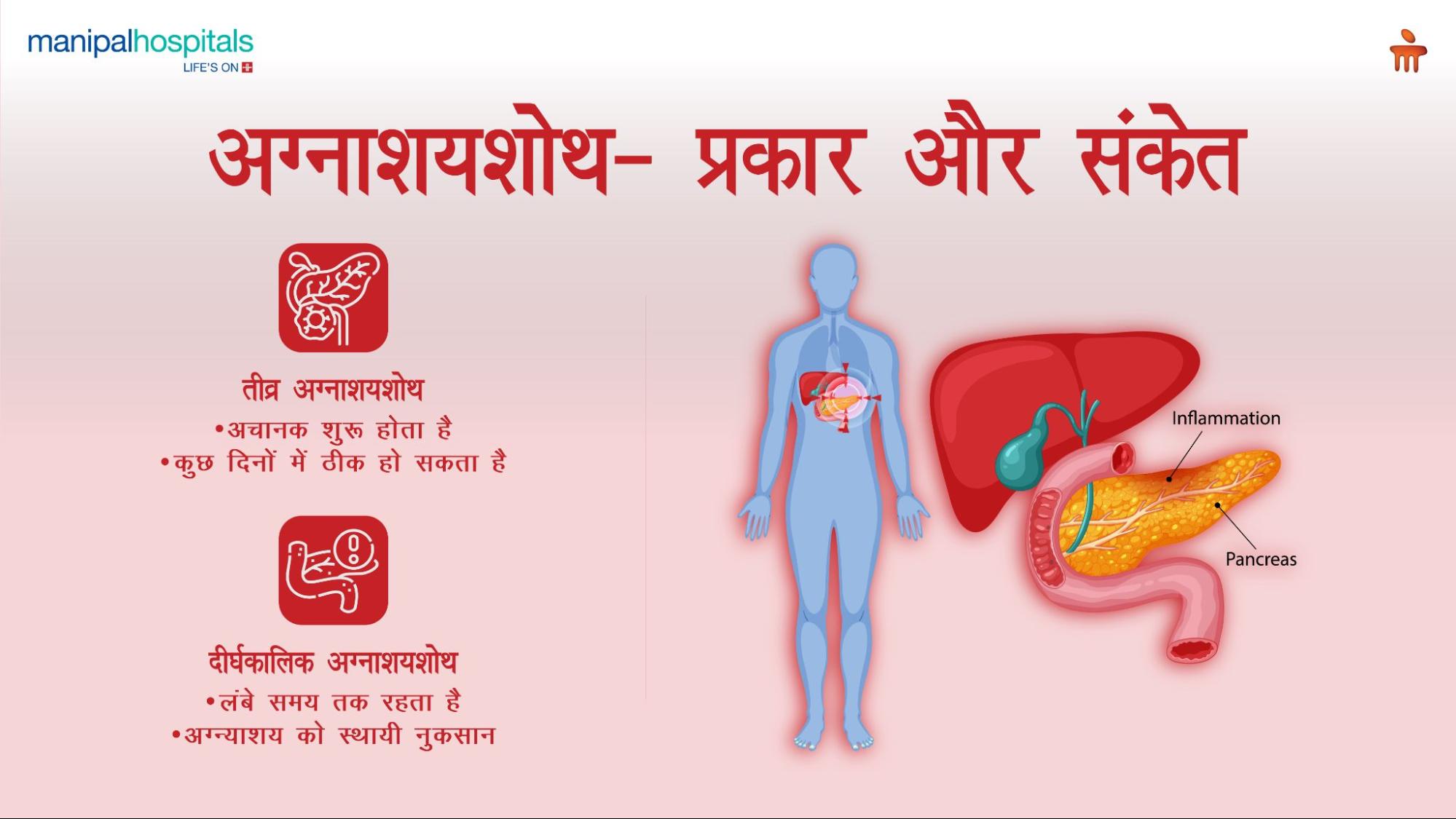 अग्नाशयशोथ का उपचार