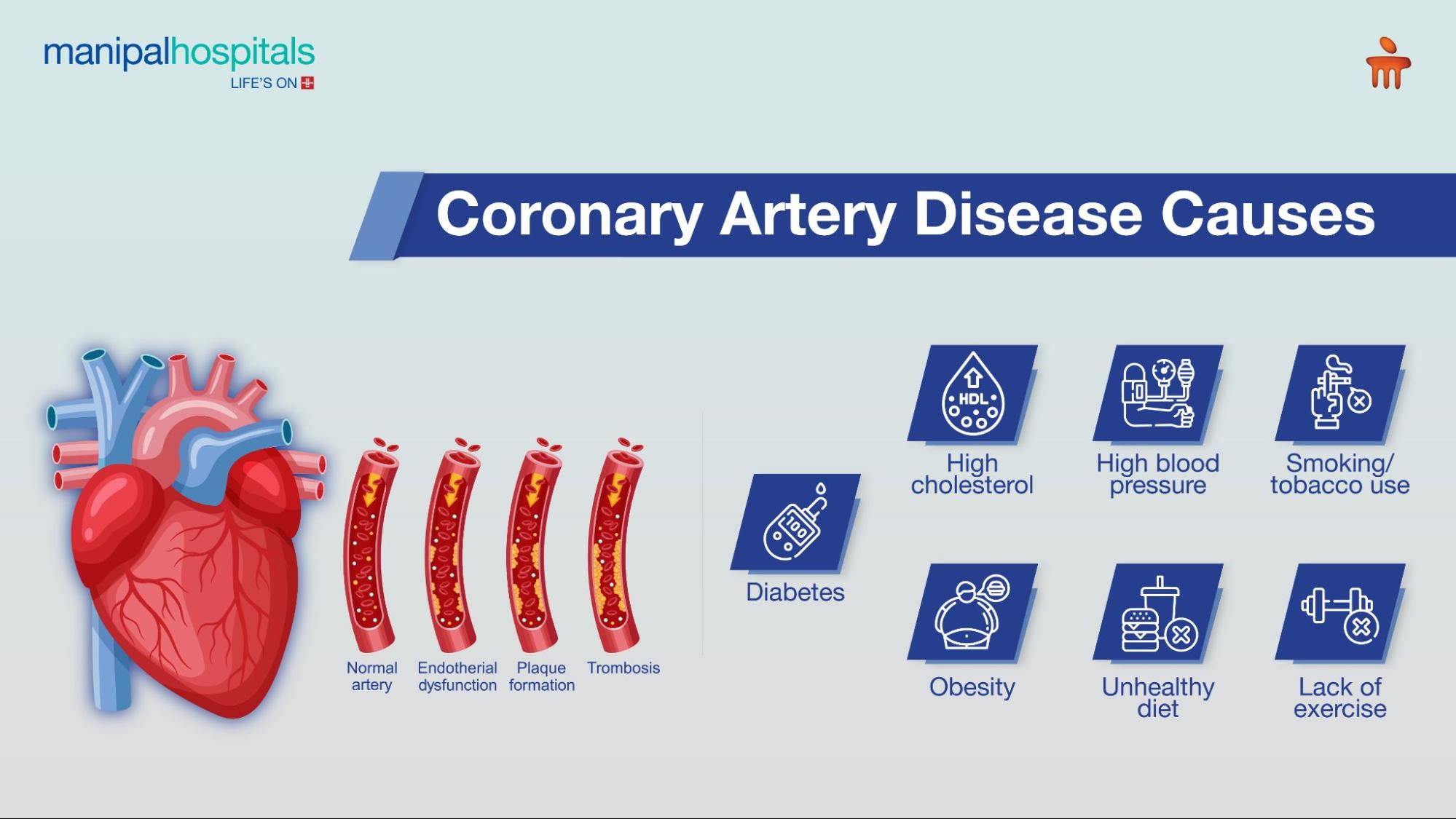 Coronary Artery Disease: Symptoms, Causes & Treatment