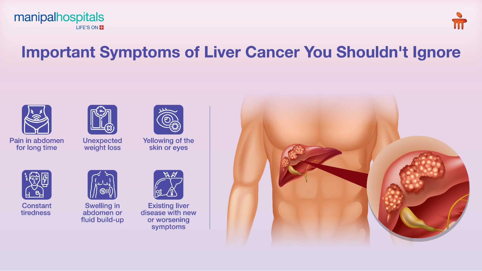Causes and risk factors linked to stage 4 liver cancer