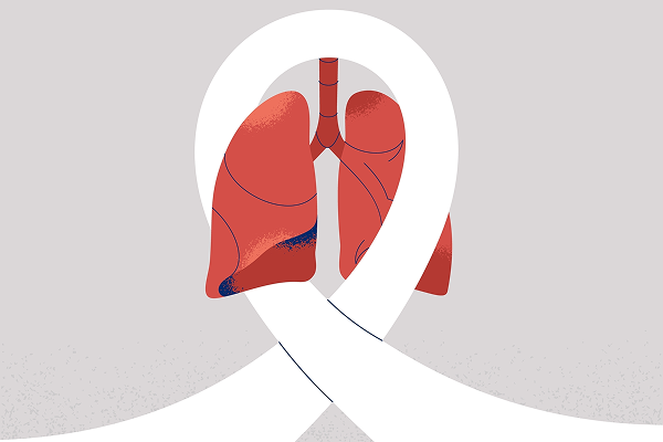 Understanding the Possibility of Curing Lung Cancer