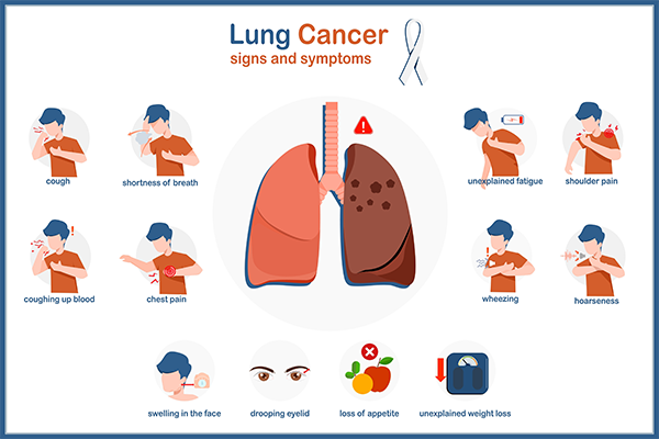 Lung Cancer Symptoms
