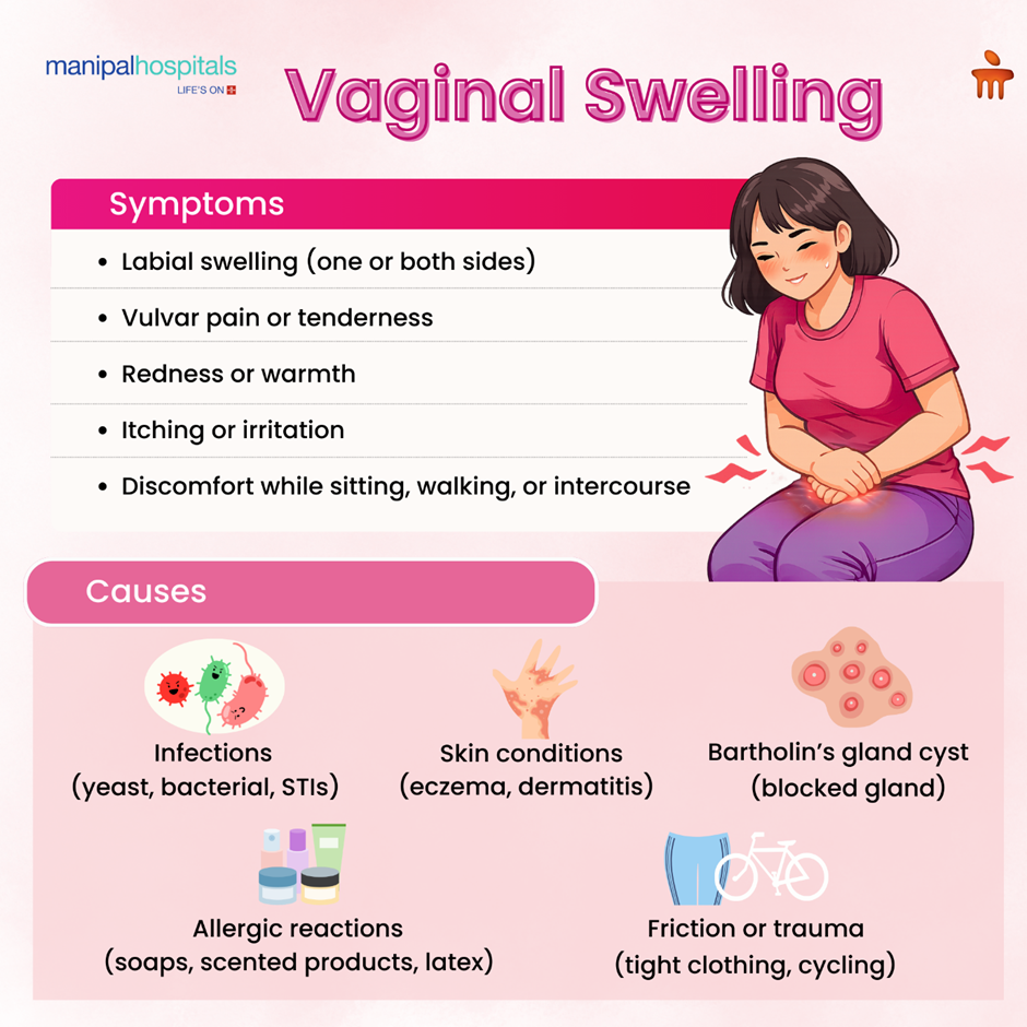 Vaginal Swelling: Causes, Symptoms, and Treatment Options