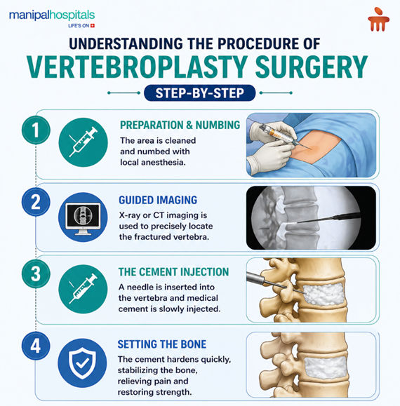 Vertebroplasty Surgery: Procedure, Benefits & Recovery