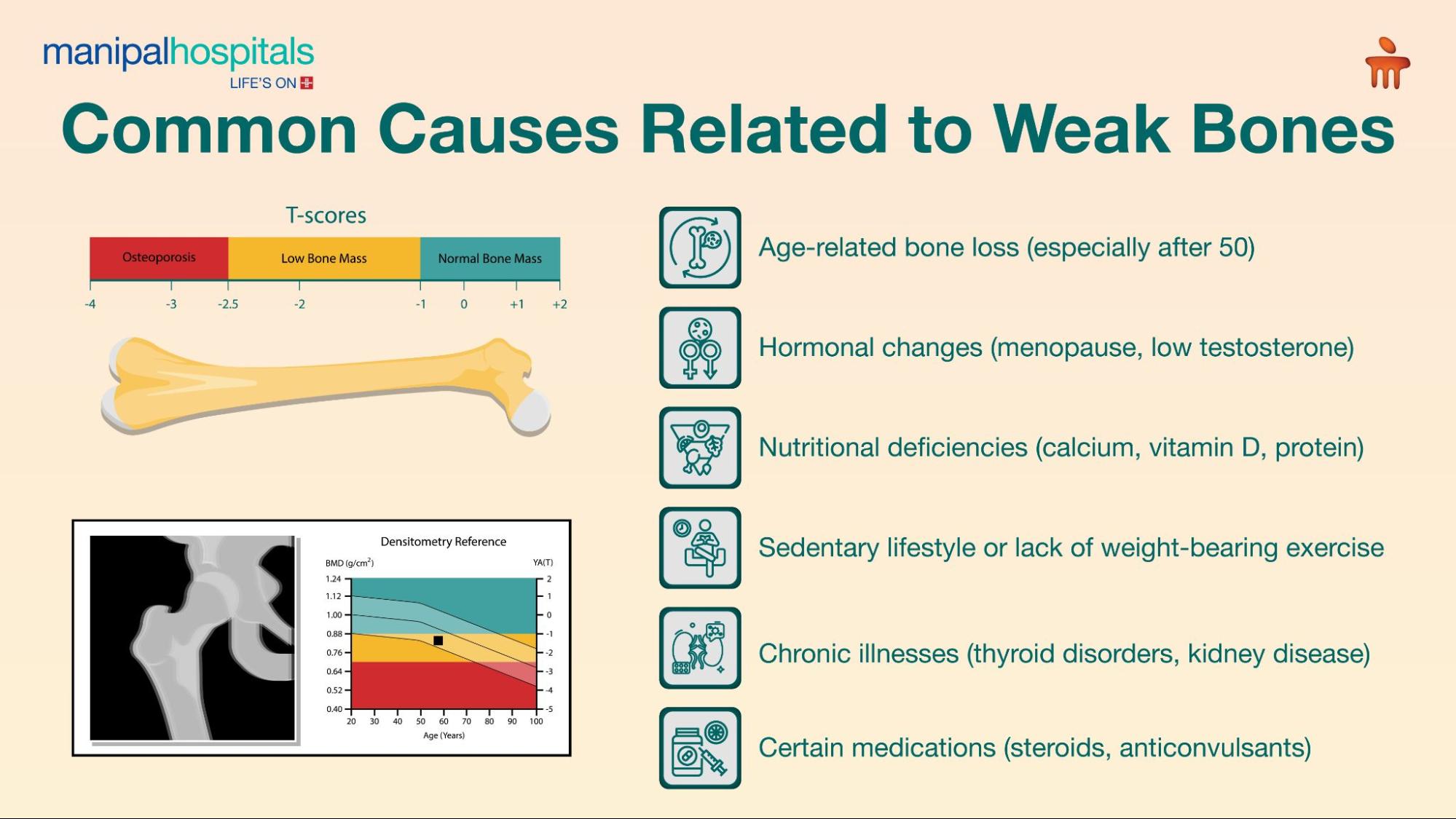 Weak Bones Symptoms Explained: Health Benefits, Nutrition, Risks and Expert Advice