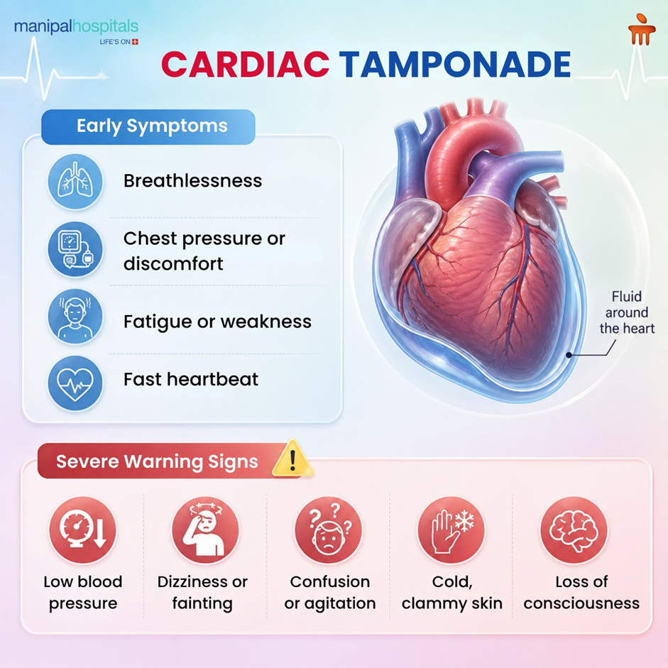 What Is Cardiac Tamponade? Symptoms, Causes & Treatment