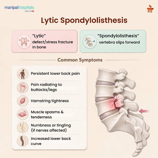 What Is Lytic Spondylolisthesis? Signs, Diagnosis, and Treatment Guide