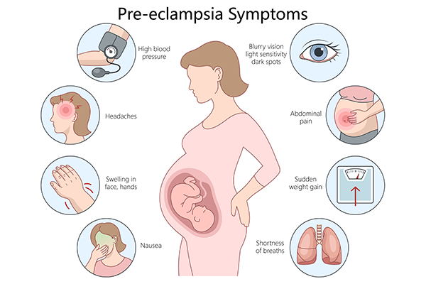 What Is Preeclampsia? Symptoms and Early Detection