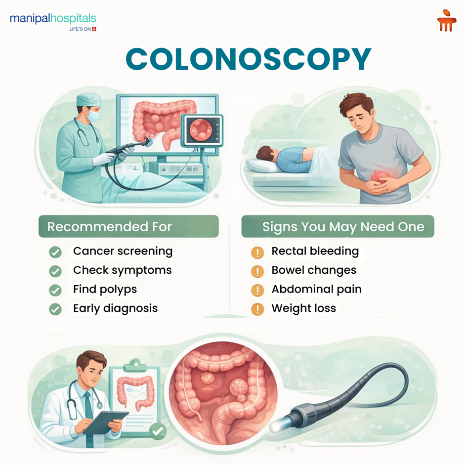 What Is a Colonoscopy? Purpose, Procedure, and When You May Need One