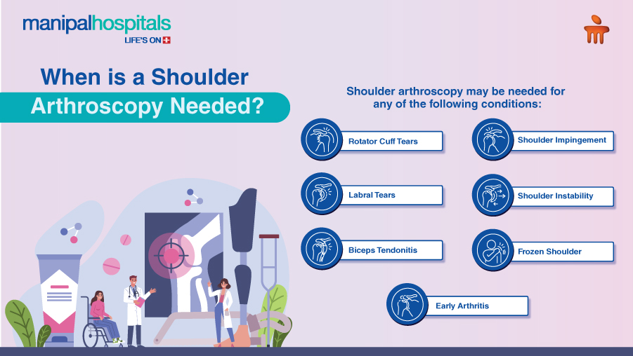 shoulder arthroscopy recovery time