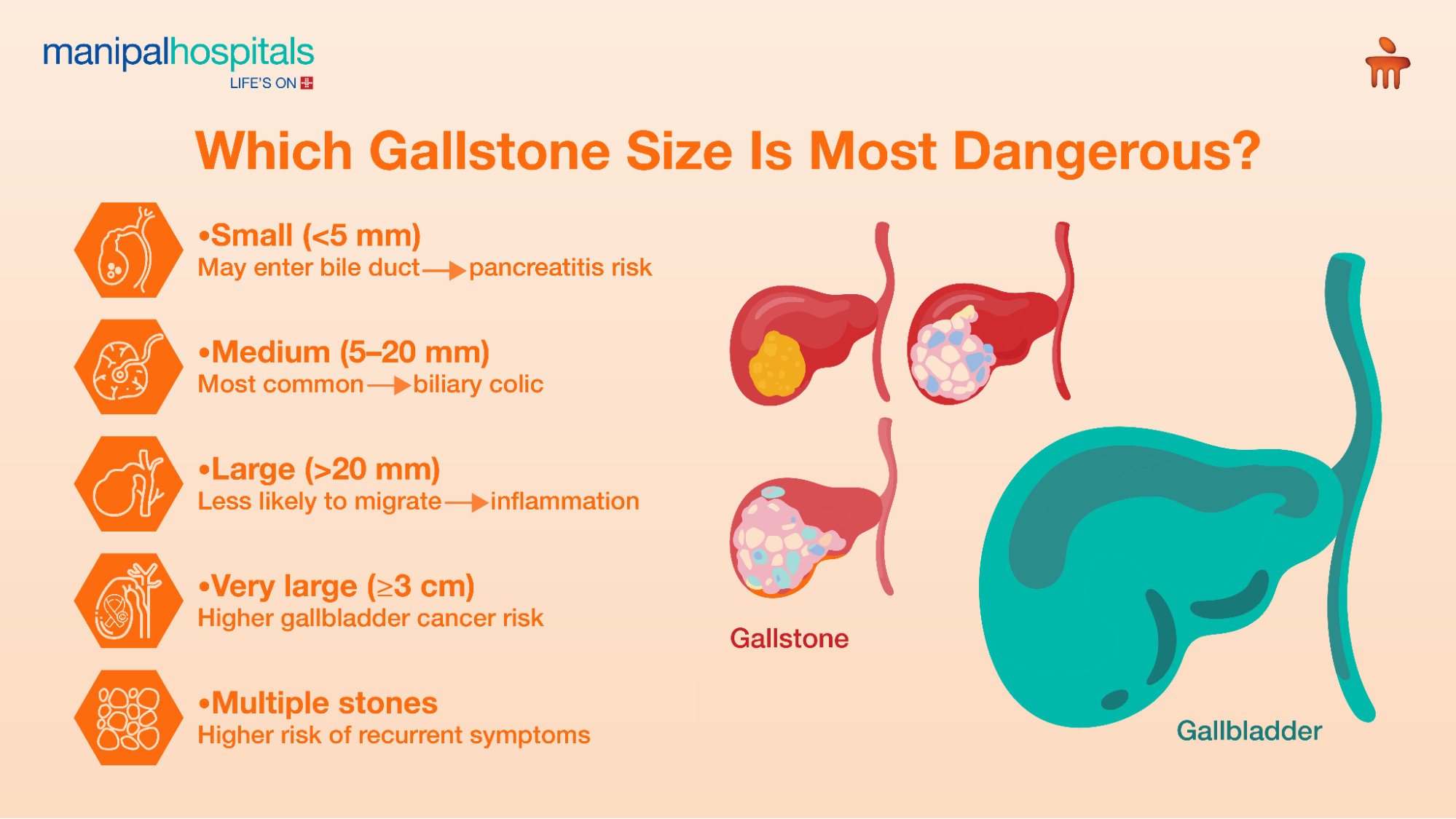 Gallstones surgery warning signs