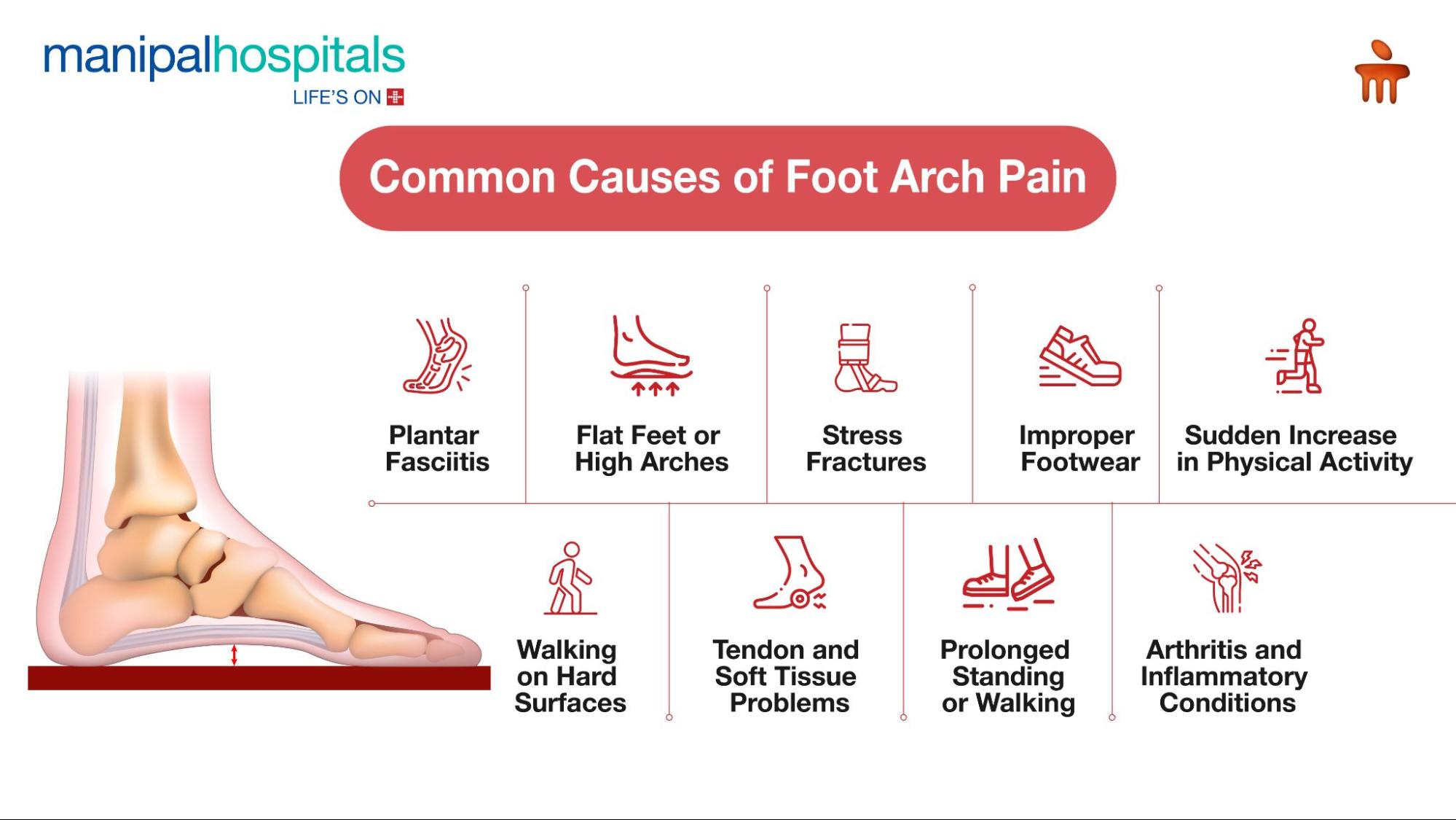 Foot Arch Pain Causes & Relief