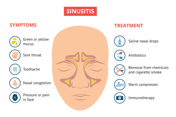 Blocked nose: causes and treaments
